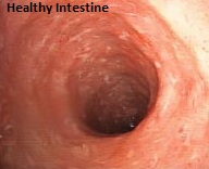healthy Intestine